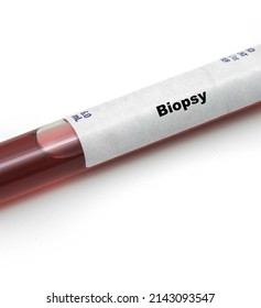 Biopsy Test Tube On White