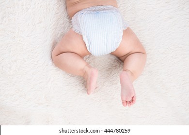 Birthmark on Asian baby girl legs