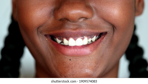 Black African Woman Lips Smiling. Macro Close-up Girl Smile