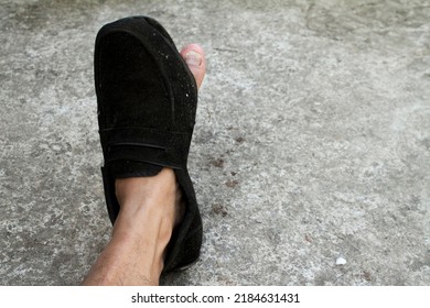 Black Formal Shoes Made Of Broken Leather With A Hole In The Front So That The Big Toe Of His Left Is Visible