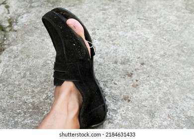 Black Formal Shoes Made Of Broken Leather With A Hole In The Front So That The Big Toe Of His Left Is Visible