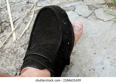 Black Formal Shoes Made Of Broken Leather With A Hole In The Front So That The Big Toe Of His Left Is Visible