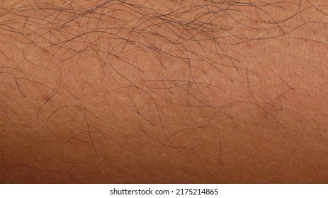 Black Human Body Hair On Tan Human Skin Background Texture