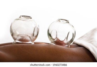 Black person receiving glass fire cupping cups