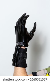 Black Prosthetic Hand On A Male Arm