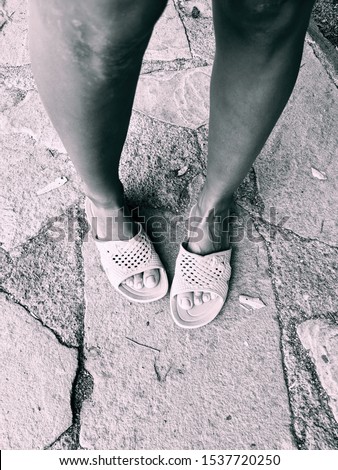black white girl legs summer poverty