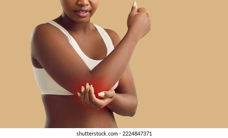 Black Woman Suffering From Arthritis, Stiff Elbow, Bruise, Or Tennis Elbow Condition Holding Hand On Painful Area On Her Arm Isolated On Beige Color Banner Background. Injury, Health Problem Concept