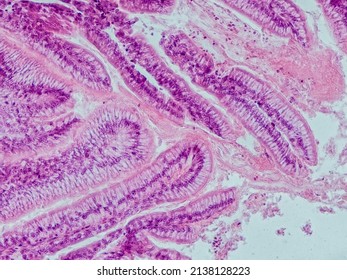 Blackbird Small Intestine Cross Section Under The Microscope Showing Intestinal Villi And Lumen - Optical Microscope X400 Magnification