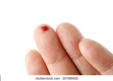 Bleeding from the cut finger