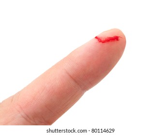 Bleeding from the cut finger isolated on white background