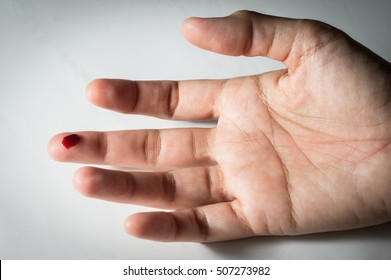 Bleeding Finger, Health Concept.