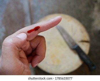 Bleeding Finger From Knife Cooking.