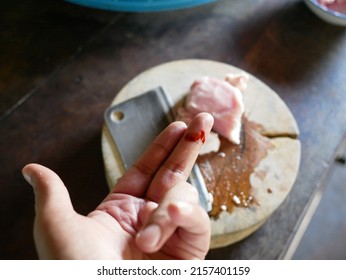 Bleeding Finger From Knife Cooking.