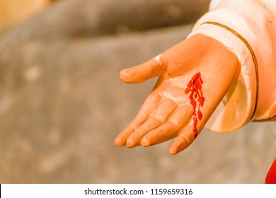 Bleeding Stigmata In Welcoming Hand