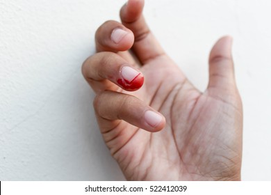 bleeding wound on finger at right hand with white background, bleeding on ring finger, soft and blurry focus