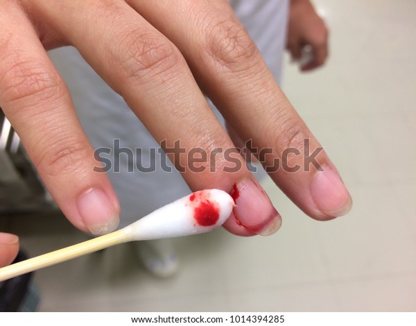 Bleeding Wound On Finger Right Hand Stock Photo Edit Now 1014394285