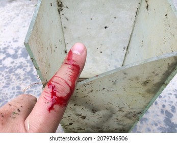 Bleeding from the wound on the index finger The injured finger was bleeding profusely as an open wound. Close-up of a human hand injured by negligence touching a broken glass that cuts a finger.