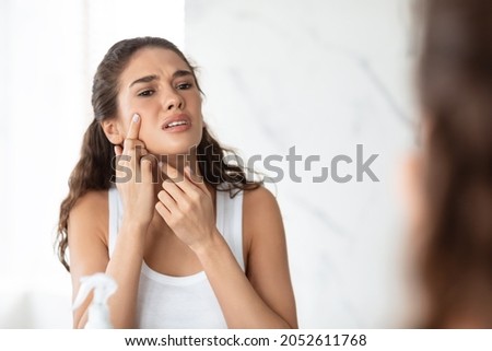 Blemish-Prone Skin And Acne. Desperate Lady Squeezing Pimple On Face Standing Near Mirror In Modern Bathroom At Home. Facial Skincare, Health Issues Concept. Selective Focus