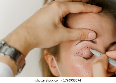 Blepharoplasty markup close-up on the face before the plastic surgery operation for modifying the eye region of the face in medical clinic. 2 doctors do plastic cosmetic operation - Shutterstock ID 1796938594