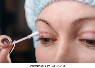 Blepharoplasty Of The Upper Eyelid.