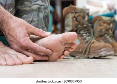 Blisters On The Foot Of A Caucasian Military Man Sitting On The Couch