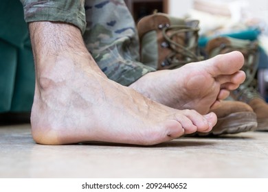 Blisters On The Foot Of A Caucasian Military Man Sitting On The Couch