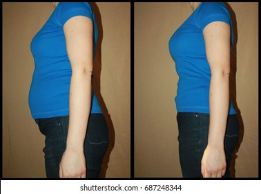 Bloated and flat female belly before and after, no photoshop interventions, no weight loss, only bulging and clenched stomach.. slimming belt products, problems with bloating, pregnancy and postpartum