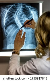 Blonde Female Physician Looking At A Patients X-ray. Scoliosis Specialist Doctor Making Measurements At The Patients X-Ray