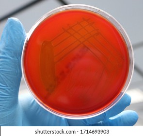 Blood Agar With Alpha Hemolysis