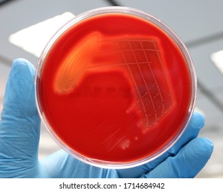 Blood agar with beta hemolysis. It is a complete lysis of red cells surrounds the bacterial colonies.