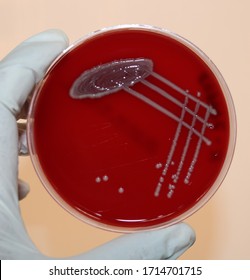 Blood Agar With Gamma Hemolysis