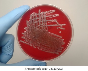 Similar Images, Stock Photos & Vectors of Colonies of Gram negative ...