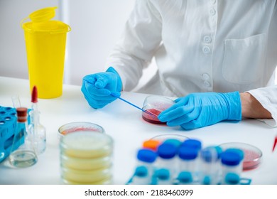 3,564 Agar blood Images, Stock Photos & Vectors | Shutterstock