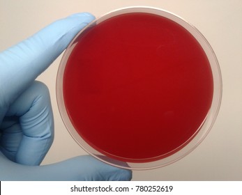 Blood Agar, Agar plate for microbiology culture medium.