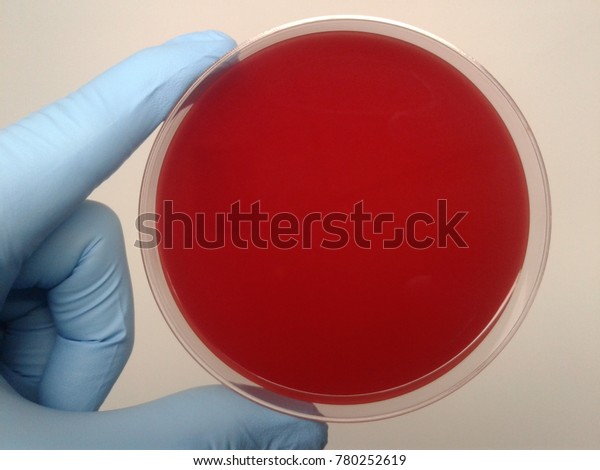Blood\
Agar, Agar plate for microbiology culture\
medium.