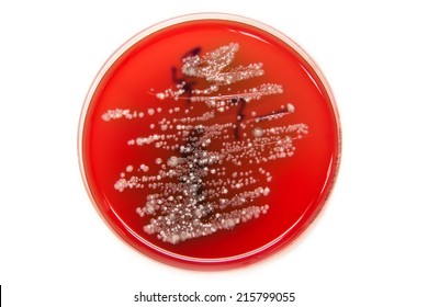 3,564 Agar blood Images, Stock Photos & Vectors | Shutterstock