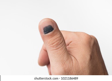 Hand Cut Blood Images, Stock Photos & Vectors | Shutterstock