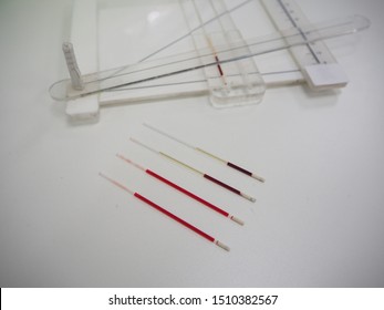 Blood In Capillary Tube For Hematocrit Test