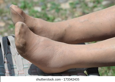 Blood Circulation Problem, Swollen Feet Of A Senior Woman