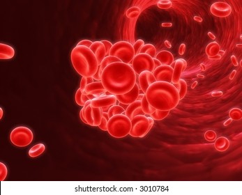 Blood Clot