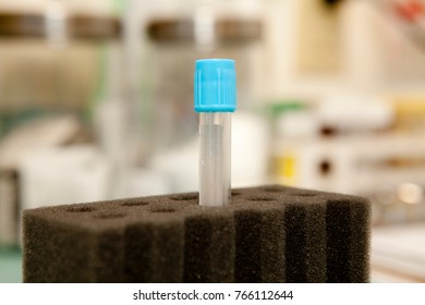 A Blood Collection Tube With Blue Cap Prominently Placed In A Foam Holder With Other Medial Supplies In The Background.  