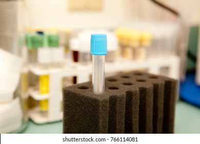 A Blood Collection Tube With Blue Cap Prominently Placed In A Foam Holder With Other Medical Supplies In The Background.  