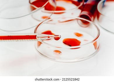 Blood Coronavirus Test.Virus Vaccine Development.Medical Laboratory.Test Tube,Petri Dish With Blood On A White Background.Concept Of Laboratory Research.Blood Test Analysis With Petri Dish Close Up.