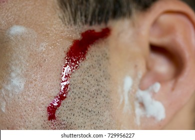 Blood Cut Shaving. Blood Flowing Down The Cheek Full Of Foam During Shaving