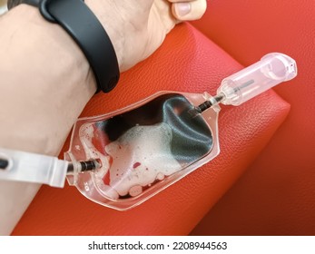 Blood Donation, Blood Transfusion, Check Specified, Fasting, Health Care. Left Arm Of Caucasian Young Man With Equipment For Blood Or Plasma Donations In Donation Centre. Blood Donation Concept. Plasm