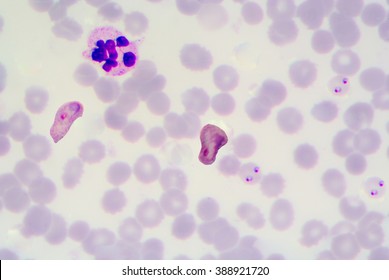 Blood Films For Malaria Parasite