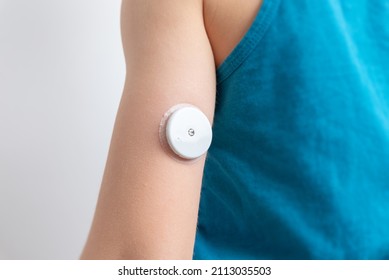 Blood Glucose Sensor On A Child's Arm.  Sensor For Remote Measurement Of Blood Glucose Levels Using NFC Technology On A Mobile Phone Or Reader 