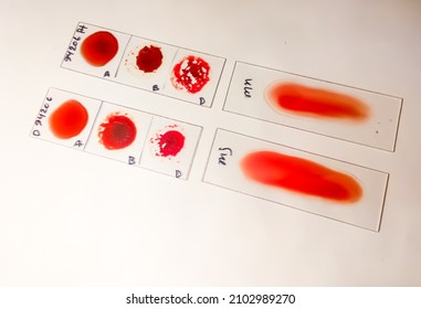  Blood Group Cross Matching. Blood Bank. Blood Donation. Blood Transfusion.