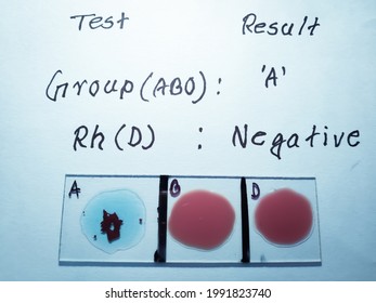 rh a negative blood type