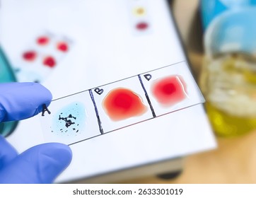 Blood group and Rh factor testing by slide agglutination method. Blood typing. A Negative (A-) blood group, a rare type of blood group.